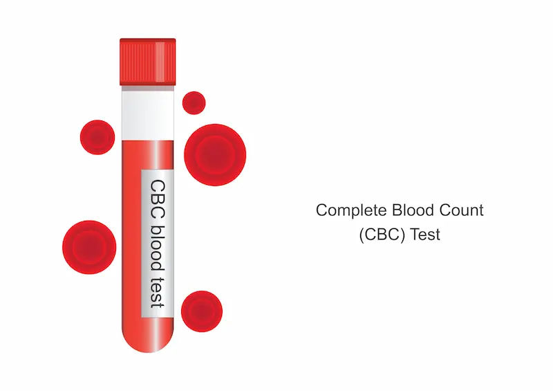 Guide to Complete Blood Count (CBC) Test